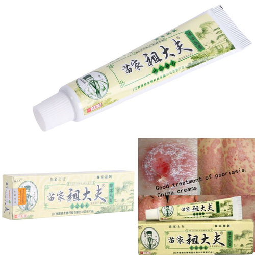 15g Psoriasis Dermatitis Eczema Treatment Anti Bacterial Skin Fungus Herbal Cream Ointment Miao