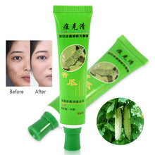 30g Acne Cream Blain Products Desalt Blain To Imprint Face Cream Face Treatment