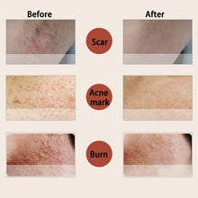 10ml Essence full-body whitening chicken skin repair essential oils remove dead skin goose bumps pimples folliculitis