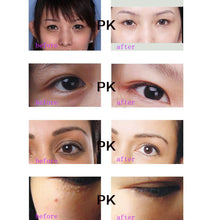 30g Anti-Dark Circle Wrinkle Anti Puffiness Wrinkles Gold Snail Repair Eye Cream
